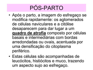 PÓS-PARTO
• Após o parto, a imagem do esfregaço se
modifica rapidamente: os aglomerados
de células naviculares e a citólise
desaparecem para dar lugar a um
quadro de atrofia composto por células
basais e intermediárias com bordas
arredondadas ou ovais, acentuada por
uma densificação do citoplasma
periférico.
• Estas células são acompanhadas de
leucócitos, histiócitos e muco, trazendo
um aspecto sujo ao esfregaço.
 