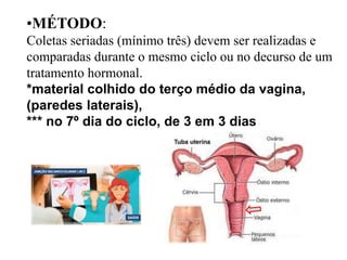 •MÉTODO:
Coletas seriadas (mínimo três) devem ser realizadas e
comparadas durante o mesmo ciclo ou no decurso de um
tratamento hormonal.
*material colhido do terço médio da vagina,
(paredes laterais),
*** no 7º dia do ciclo, de 3 em 3 dias
 