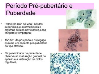 Período Pré-pubertário e
Puberdade
• Primeiros dias de vida: células
superficiais e intermediárias e
algumas células naviculares.Essa
imagem é temporária.
• 15º dia: do pós parto o esfregaço
assume um aspecto pré-pubertário
do tipo atrófico.
• Na proximidade da puberdade
observa-se maturação gradual do
epitélio e a instalação de ciclos
regulares.
 
