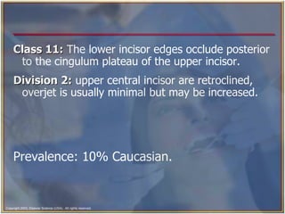 Class 11:  The lower incisor edges occlude posterior to the cingulum plateau of the upper incisor. Division 2:  upper central incisor are retroclined, overjet is usually minimal but may be increased. Prevalence: 10% Caucasian. 