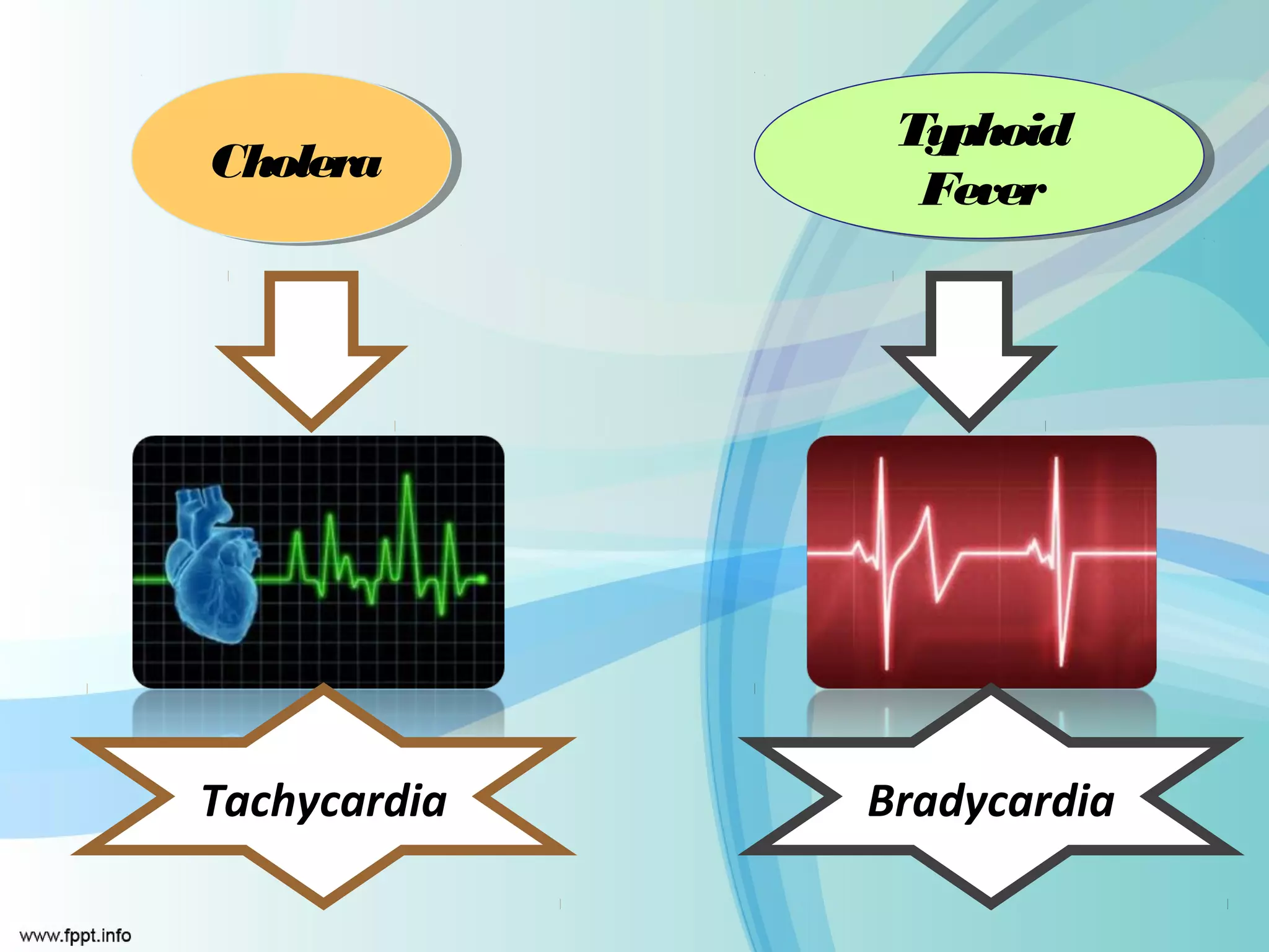 Typhoid
               Typhoid
Cholera
Cholera
                Fever
                Fever




Tachycardia   Bradycardia
 