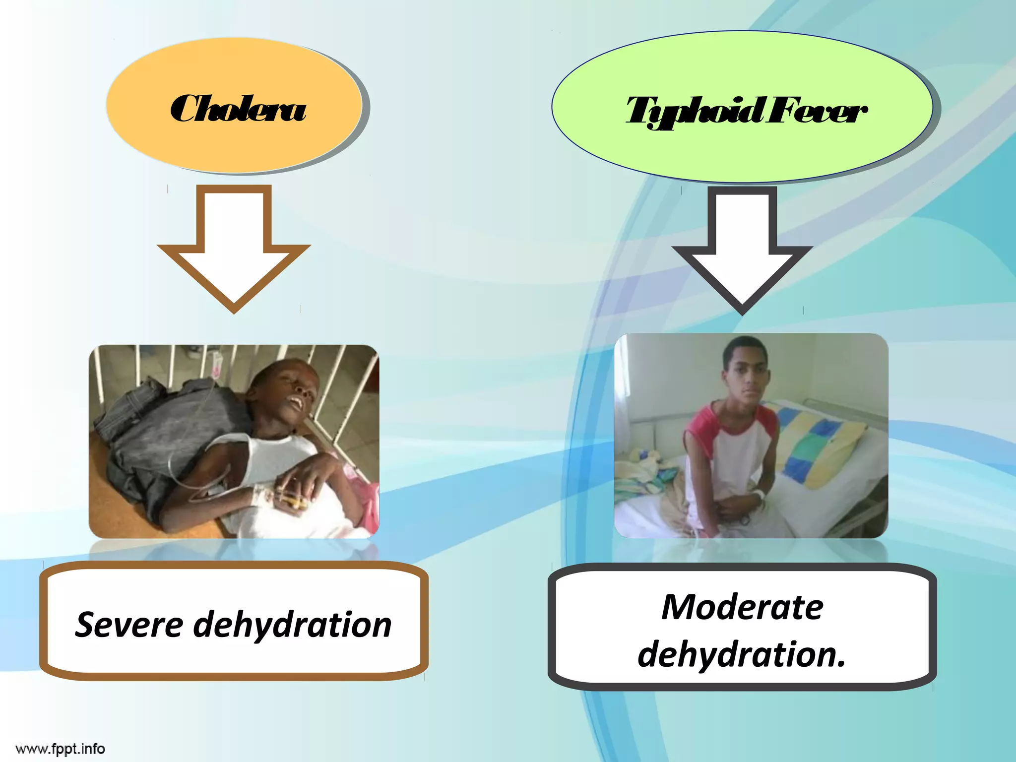 Cholera
     Cholera         TyphoidFever
                     Typhoid Fever




Severe dehydration    Moderate
                     dehydration.
 