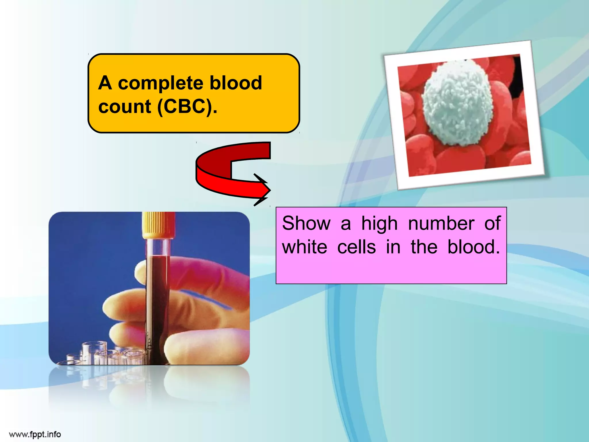 A complete blood
count (CBC).




                   Show a high number of
                   white cells in the blood.
 