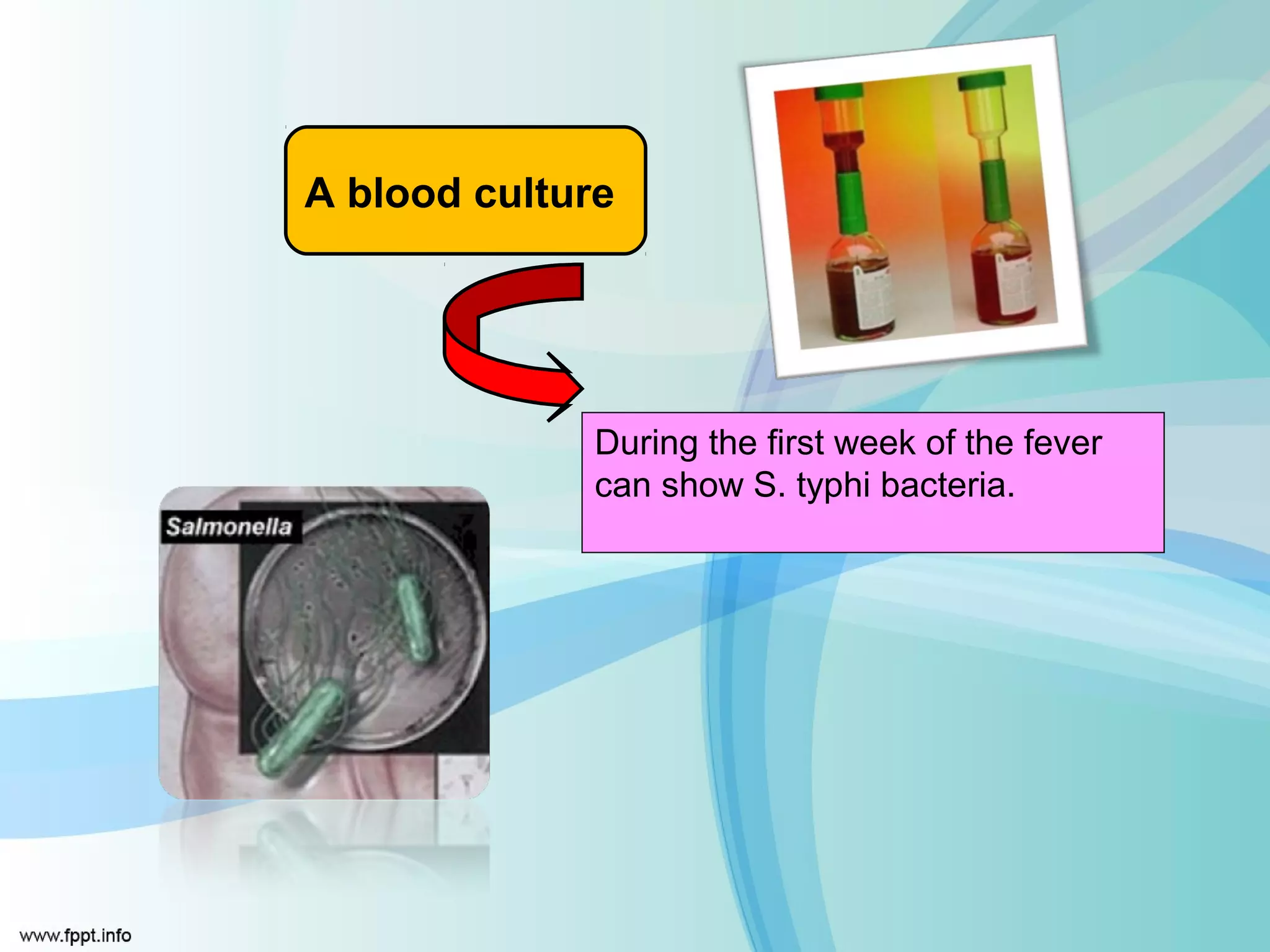 A blood culture




              During the first week of the fever
              can show S. typhi bacteria.
 