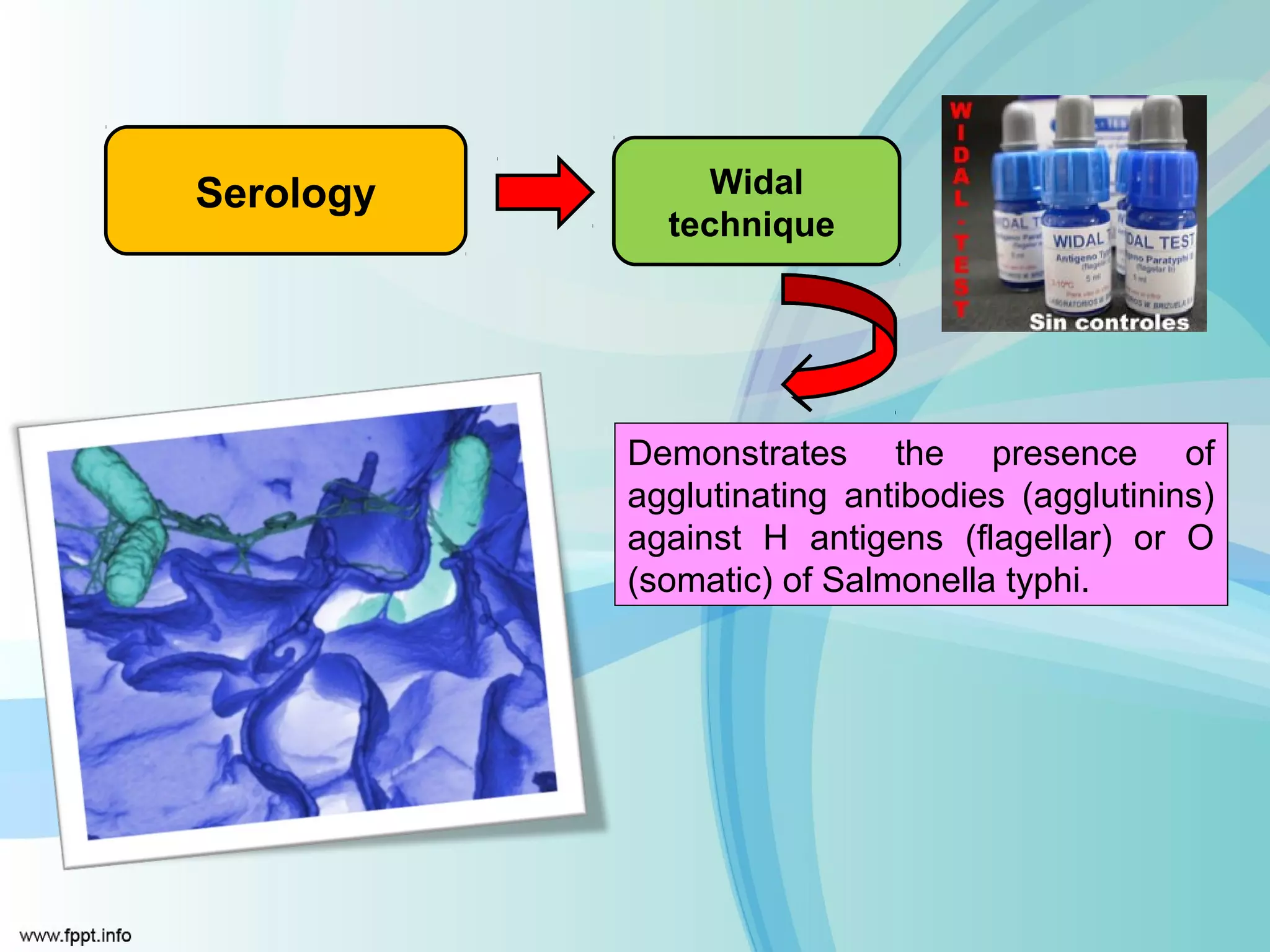 Serology       Widal
             technique




           Demonstrates the presence of
           agglutinating antibodies (agglutinins)
           against H antigens (flagellar) or O
           (somatic) of Salmonella typhi.
 