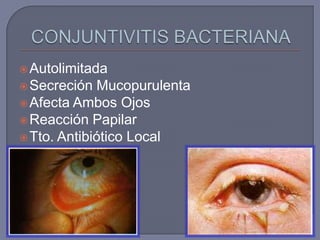  Autolimitada
 Secreción  Mucopurulenta
 Afecta Ambos Ojos
 Reacción Papilar
 Tto. Antibiótico Local
 