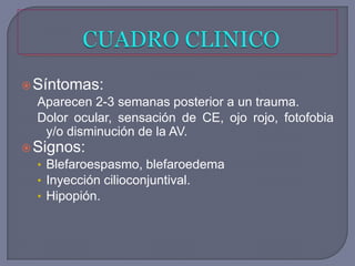  Síntomas:
  Aparecen 2-3 semanas posterior a un trauma.
  Dolor ocular, sensación de CE, ojo rojo, fotofobia
   y/o disminución de la AV.
 Signos:
  • Blefaroespasmo, blefaroedema
  • Inyección cilioconjuntival.
  • Hipopión.
 