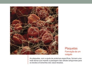 Plaquetas
Formação de um
coágulo
As plaquetas, com a ajuda de proteínas específicas, formam uma
rede densa que impede a passagem das células sanguíneas para
os tecidos envolventes dos vasos lesados.
 