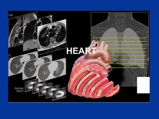 Chapter 6- Chest & Cardiovascular radiology.pdf