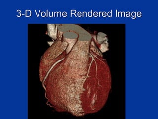 Chapter 6- Chest & Cardiovascular radiology.pdf