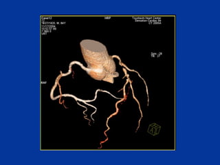 Chapter 6- Chest & Cardiovascular radiology.pdf