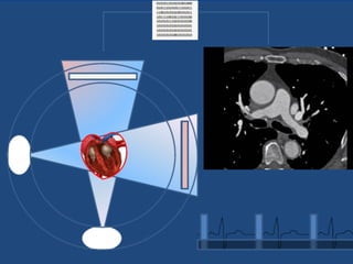 Chapter 6- Chest & Cardiovascular radiology.pdf