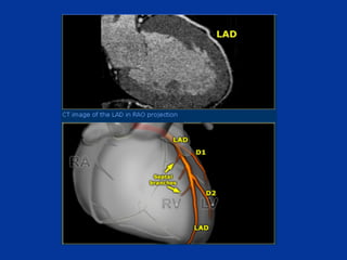 Chapter 6- Chest & Cardiovascular radiology.pdf