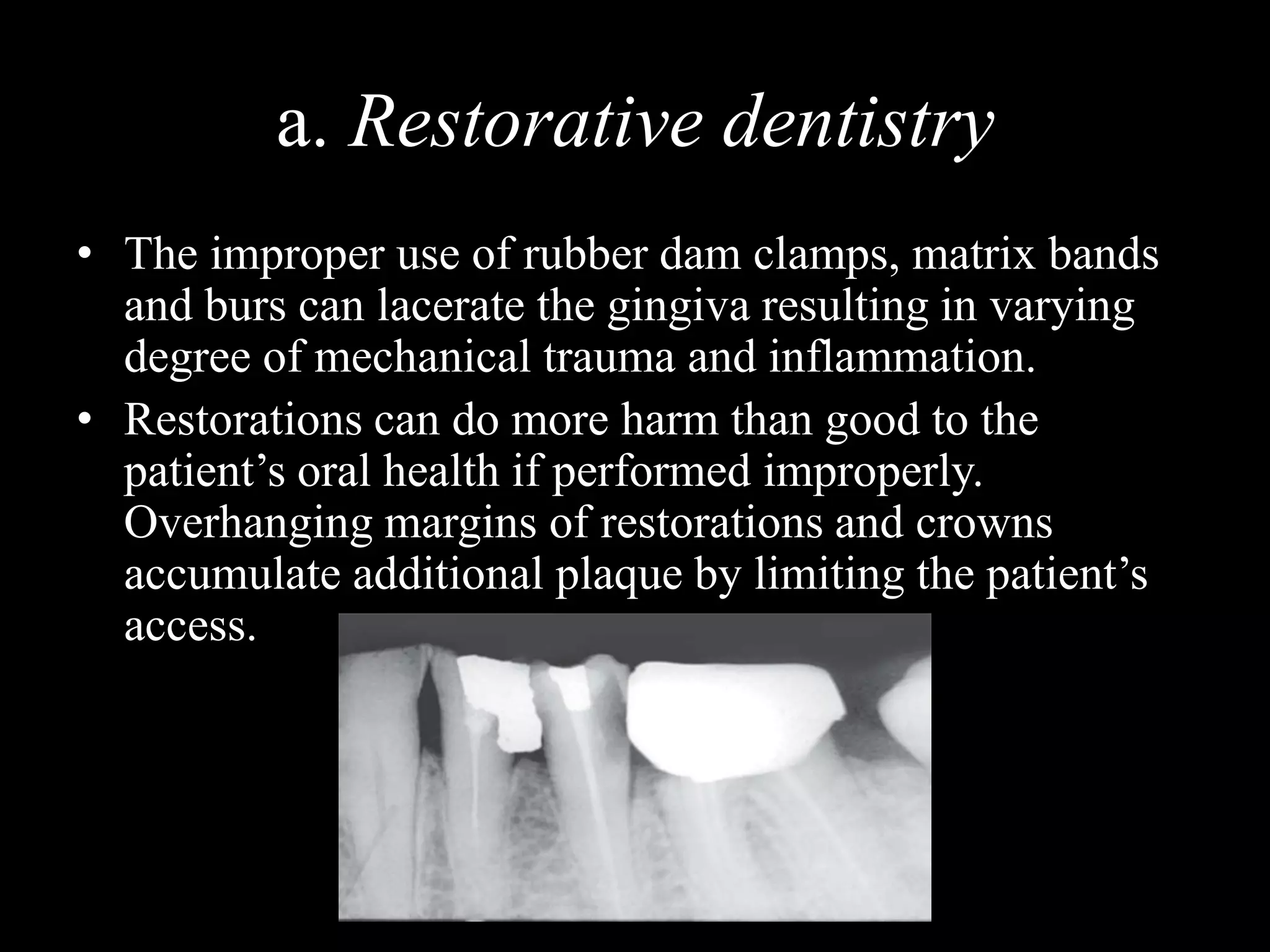 a. Restorative dentistry
• The improper use of rubber dam clamps, matrix bands
and burs can lacerate the gingiva resulting in varying
degree of mechanical trauma and inflammation.
• Restorations can do more harm than good to the
patient’s oral health if performed improperly.
Overhanging margins of restorations and crowns
accumulate additional plaque by limiting the patient’s
access.
 