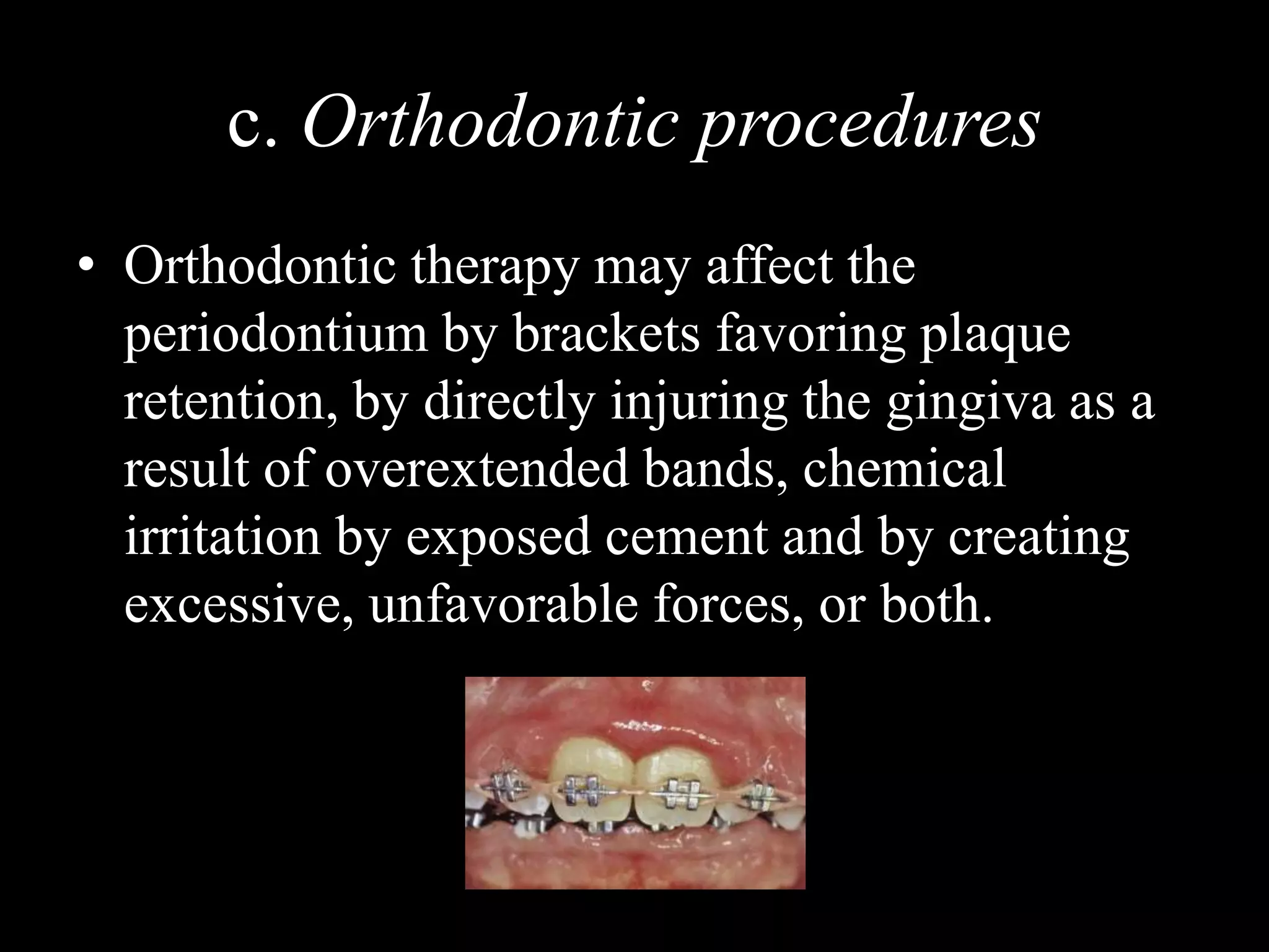c. Orthodontic procedures
• Orthodontic therapy may affect the
periodontium by brackets favoring plaque
retention, by directly injuring the gingiva as a
result of overextended bands, chemical
irritation by exposed cement and by creating
excessive, unfavorable forces, or both.
 