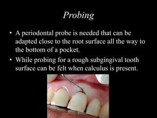 Probing
• A periodontal probe is needed that can be
adapted close to the root surface all the way to
the bottom of a pocket.
• While probing for a rough subgingival tooth
surface can be felt when calculus is present.
 