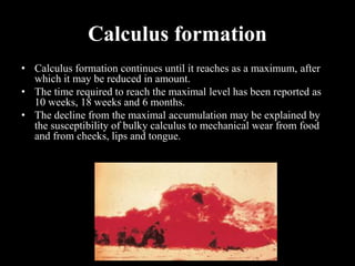 Calculus formation
• Calculus formation continues until it reaches as a maximum, after
which it may be reduced in amount.
• The time required to reach the maximal level has been reported as
10 weeks, 18 weeks and 6 months.
• The decline from the maximal accumulation may be explained by
the susceptibility of bulky calculus to mechanical wear from food
and from cheeks, lips and tongue.
 