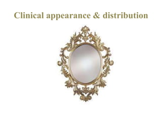 Clinical appearance & distribution
 