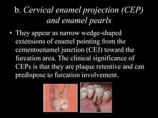 b. Cervical enamel projection (CEP)
and enamel pearls
• They appear as narrow wedge-shaped
extensions of enamel pointing from the
cementoenamel junction (CEJ) toward the
furcation area. The clinical significance of
CEPs is that they are plaque retentive and can
predispose to furcation involvement.
 