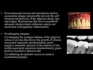 • Overcontoured crowns and restorations tend to
accumulate plaque and possibly prevent the self-
cleaning mechanisms of the adjacent cheek, lips,
and tongue. Restorations that fail to reestablish
adequate interproximal embrasure spaces are
associated with papillary inflammation.
• Overhanging margins:
(1) changing the ecologic balance of the gingival
sulcus to an area that favors the growth of disease-
associated organisms (predominately gram-
negative anaerobic species) at the expense of the
health-associated organisms (predominately gram-
positive facultative species) and
(2) inhibiting the patient's access to remove
accumulated plaque.
 