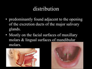 distribution
• predominantly found adjacent to the opening
of the excretion ducts of the major salivary
glands.
• Mostly on the facial surfaces of maxillary
molars & lingual surfaces of mandibular
molars.
 
