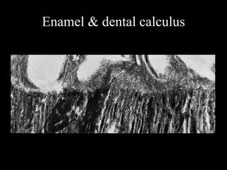 Enamel & dental calculus
 