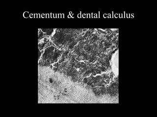 Cementum & dental calculus
 