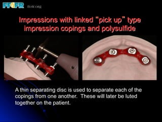 Impressions with linked “pick up” type
   impression copings and polysulfide




A thin separating disc is used to separate each of the
copings from one another. These will later be luted
together on the patient.
 