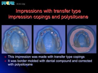 Impressions with transfer type
      impression copings and polysiloxane




v    This impression was made with transfer type copings
v    It was border molded with dental compound and corrected
      with polysiloxane
 
