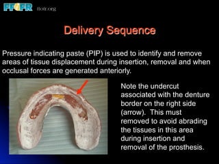 Delivery Sequence

Pressure indicating paste (PIP) is used to identify and remove
areas of tissue displacement during insertion, removal and when
occlusal forces are generated anteriorly.

                                   Note the undercut
                                   associated with the denture
                                   border on the right side
                                   (arrow). This must
                                   removed to avoid abrading
                                   the tissues in this area
                                   during insertion and
                                   removal of the prosthesis.
 