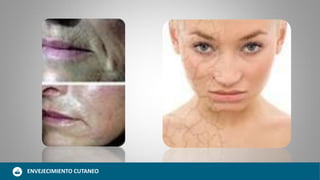 ENVEJECIMIENTO CUTANEO
 