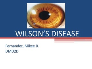 WILSON’S DISEASE
Fernandez, Mikee B.
DMD2D
 