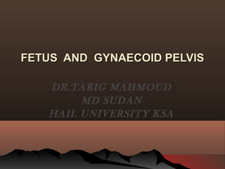FETUS AND GYNAECOID PELVISFETUS AND GYNAECOID PELVIS
DR.TARIG MAHMOUD
MD SUDAN
HAIL UNIVERSITY KSA
 