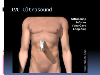 IVC Ultrasound
 