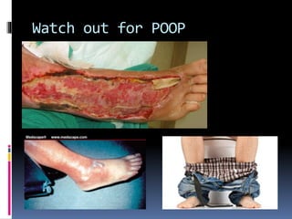 Watch out for POOP
 