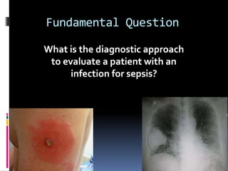 Fundamental Question
What is the diagnostic approach
to evaluate a patient with an
infection for sepsis?
 