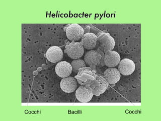 Helicobacter pylori Cocchi  Bacilli Cocchi 