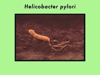 Helicobacter pylori   