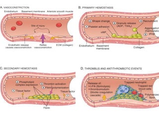 •   Three primary causes for thrombus formation,

    the so-called Virchow triad:

     (1) Endothelial injury

     (2) ...