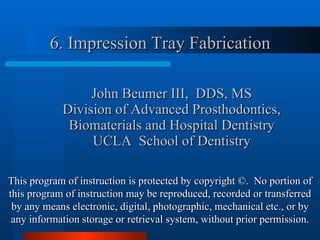 John Beumer III,  DDS, MS Division of Advanced Prosthodontics, Biomaterials and Hospital Dentistry UCLA  School of Dentistry ,[object Object],This program of instruction is protected by copyright ©.  No portion of this program of instruction may be reproduced, recorded or transferred by any means electronic, digital, photographic, mechanical etc., or by any information storage or retrieval system, without prior permission. 