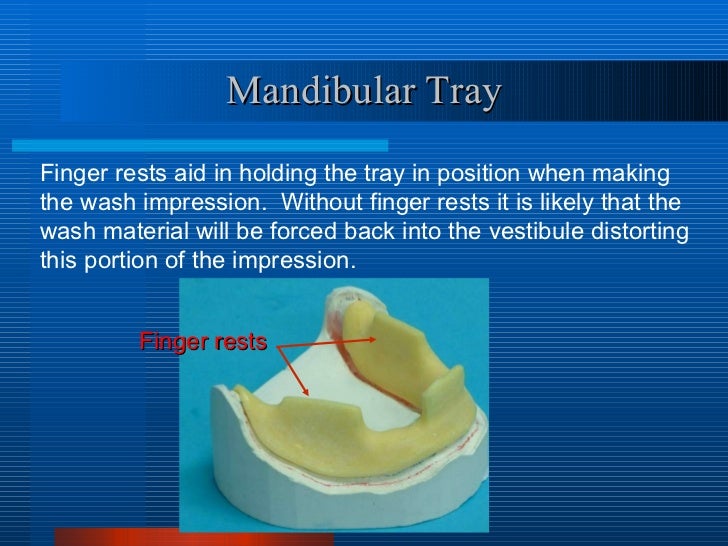 6. impression tray fabrication