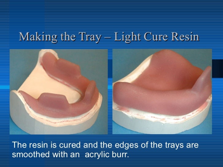 6. impression tray fabrication