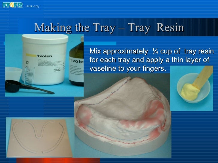 6. impression tray fabrication