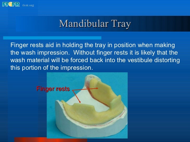 6. impression tray fabrication