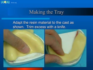 Adapt the resin material to the cast as shown.  Trim excess with a knife. Making the Tray 
