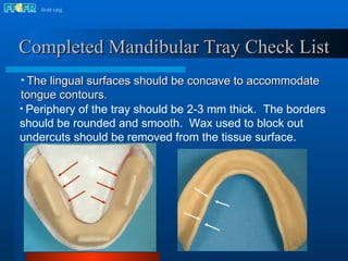Completed Mandibular Tray Check List The lingual surfaces should be concave to accommodate  tongue contours. Periphery of the tray should be 2-3 mm thick.  The borders  should be rounded and smooth.  Wax used to block out  undercuts should be removed from the tissue surface. 