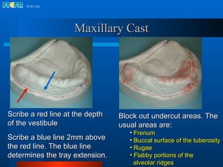 Scribe a red line at the depth of the vestibule Scribe a blue line 2mm above the red line. The blue line determines the tray extension. Block out undercut areas. The usual areas are: Frenum Buccal surface of the tuberosity Rugae Flabby portions of the  alveolar ridges Maxillary Cast 