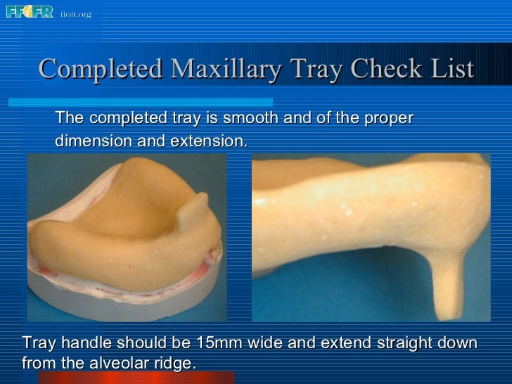 6. impression tray fabrication