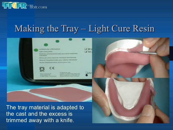 6. impression tray fabrication