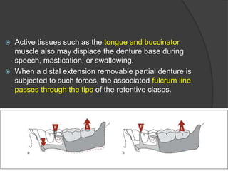 INDIRECT RETAINERS IN REMOVABLE PARTIAL DENTURES | PPTX